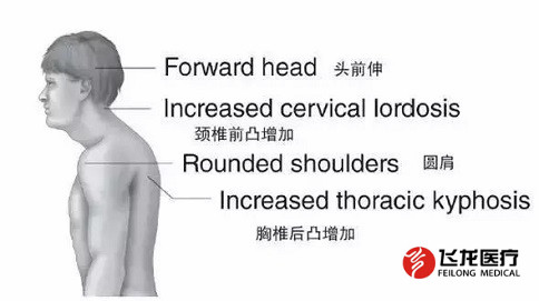 脊柱健康，不向生活“低頭”